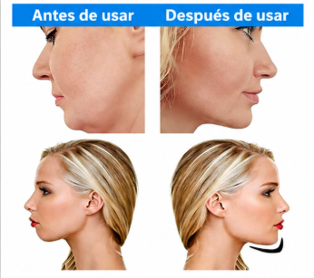Ejercitador De Mandibula (6 pcs)